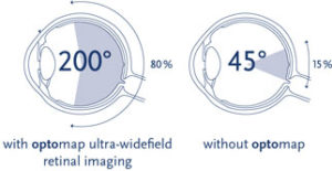 optos-imaging