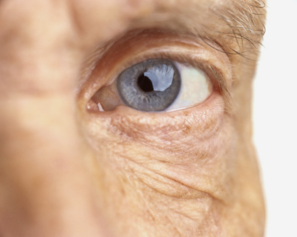 What is Diabetic Retinopathy?